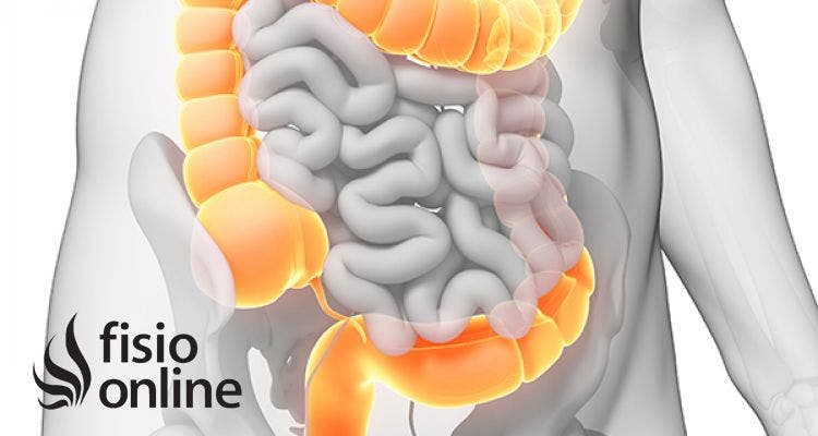 Grueso inflama intestino porque el se